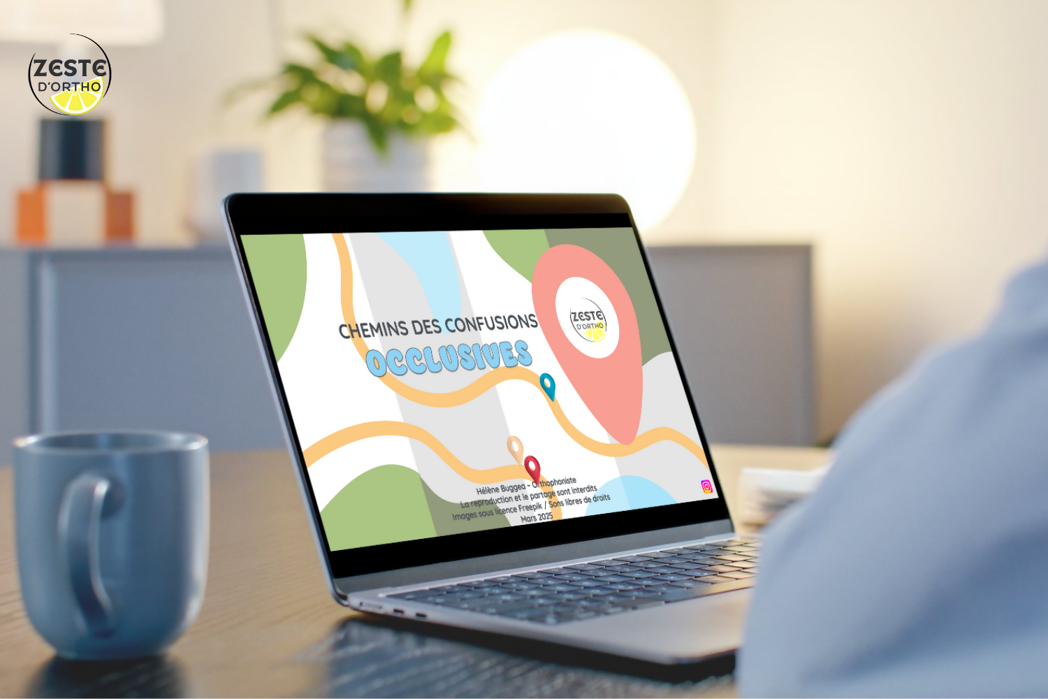 Chemins des confusions : occlusives sourdes / sonores (p/b, t/d, k/g)